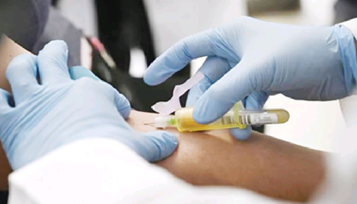 Hiv-Screening
